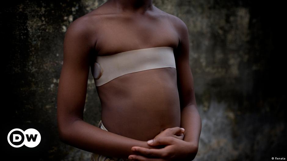 Cameroon,breast ironing,taboo,sexual abuse,sexual assault,women's righ...